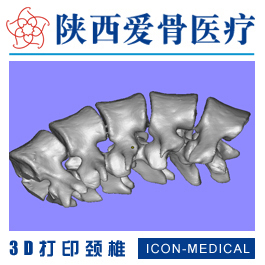 <b>3D打印颈椎（PLA材质）</b>
